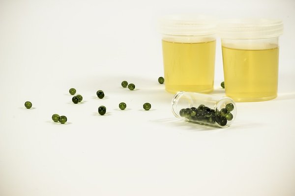 Comment lutter contre la rétention de l'urine?